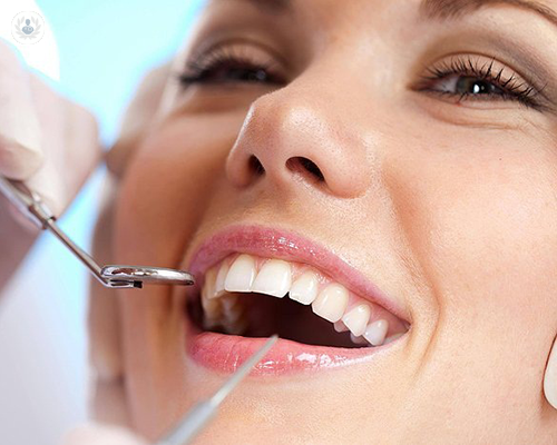 Veneers and how dental mock-ups can help you decide on your new smile