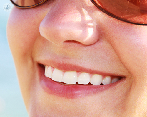 crown-veneers