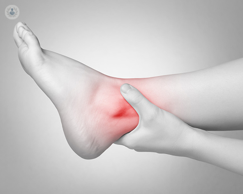 Ankle arthritis: what is subtalar arthritis?