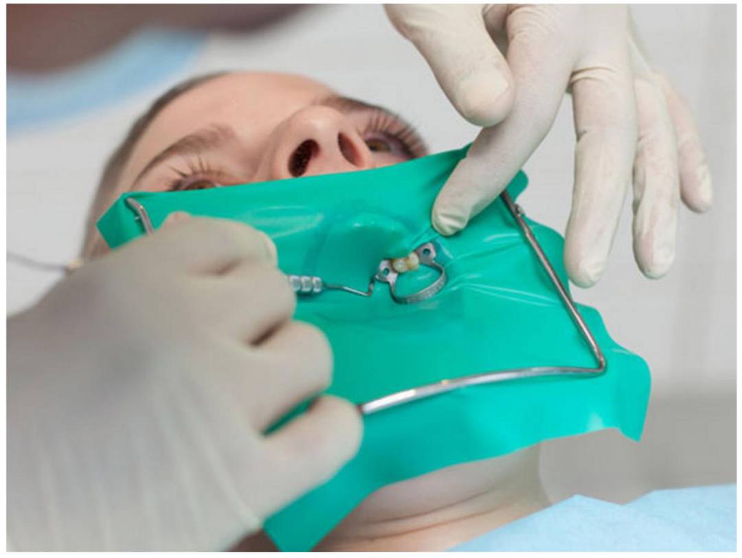 ما الفرق بين طبيب الأسنان وطبيب جذور الأسنان؟