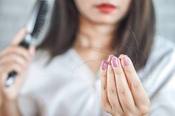 causes-of-hair-loss صورة المقال